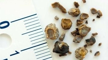 Stone Breaker (Chanca Piedra): The Plant, the Name and What Is in Our Capsules